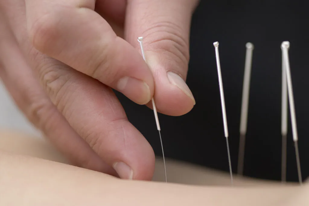 Medicina Tradicional Chinesa: A Filosofia do Equilíbrio na Acupuntura 1 image 38