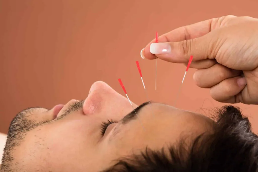 Medicina Tradicional Chinesa: A Filosofia do Equilíbrio na Acupuntura 3 image 40